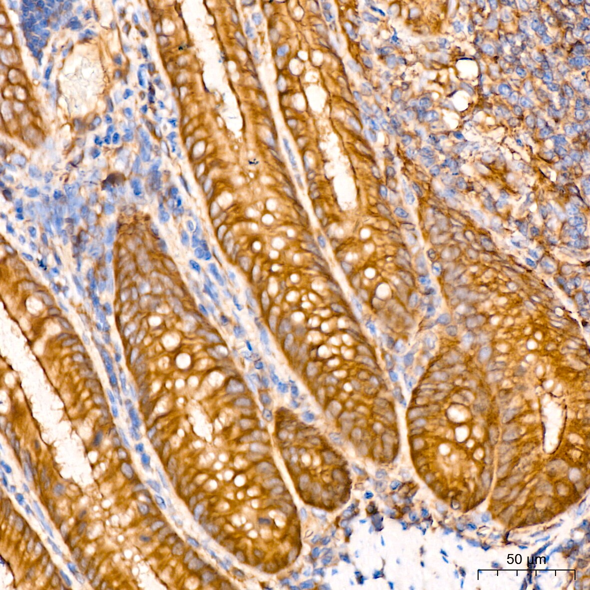 Annexin A2 Antibody (1W2B5)