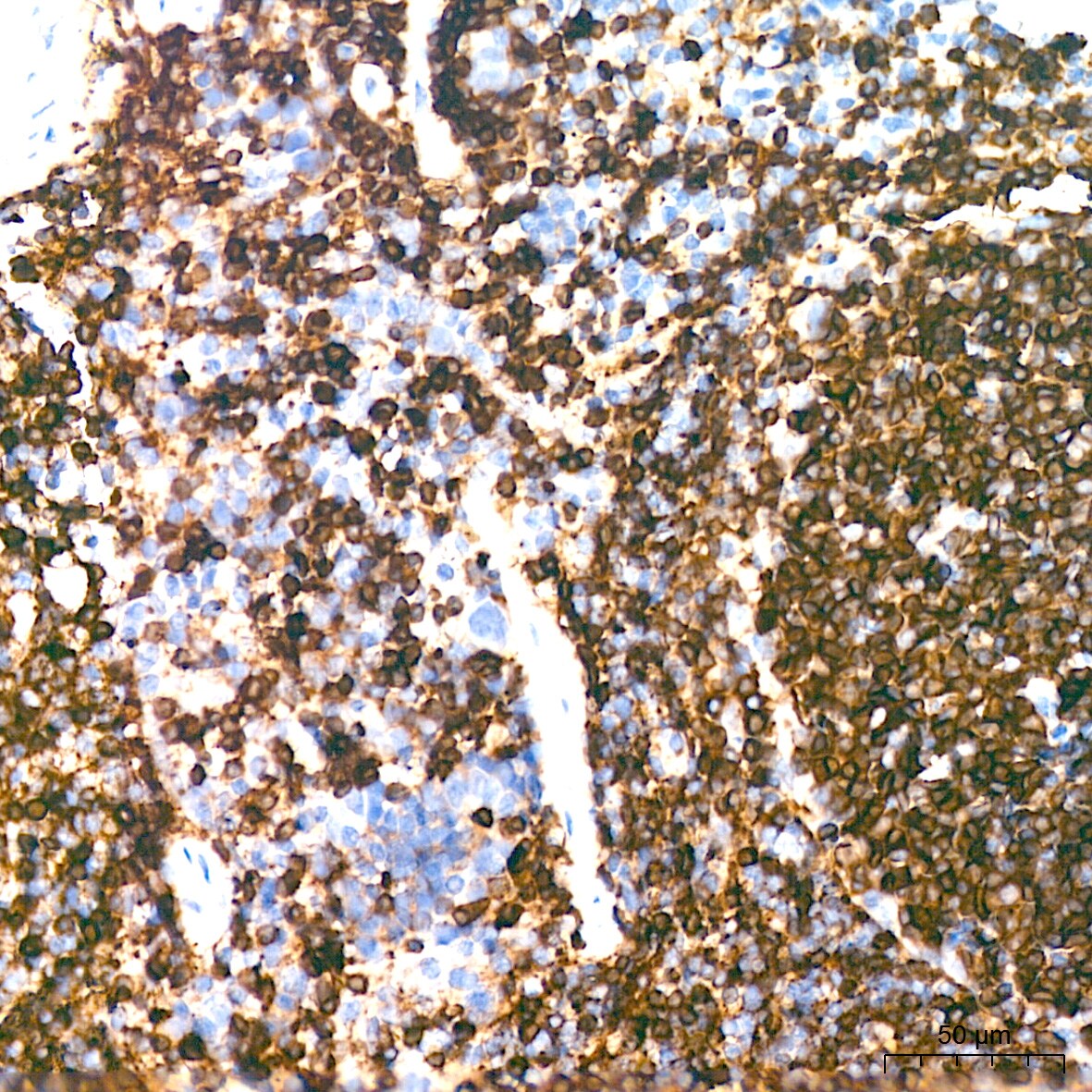 HLA DQA1 Antibody (7W0M7)
