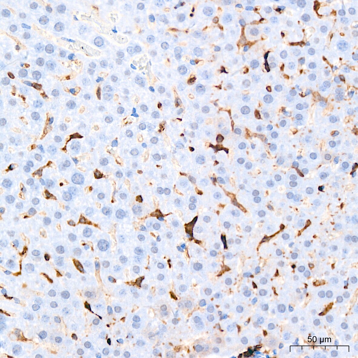 HLA DQA1 Antibody (7W0M7)