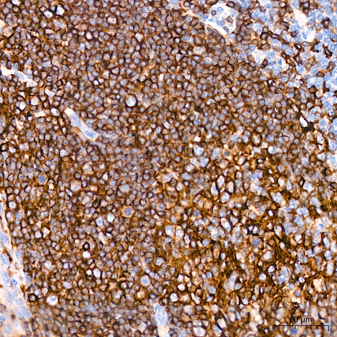 HLA DQA1 Antibody (7W0M7)