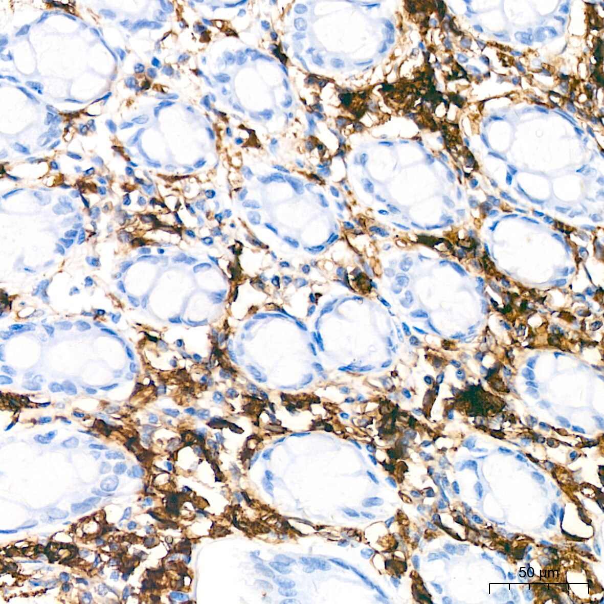 HLA DQA1 Antibody (7W0M7)