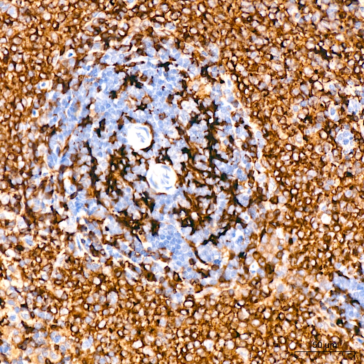 HLA DQA1 Antibody (7W0M7)