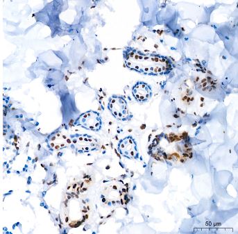 FGF basic/FGF2/bFGF Antibody (8W6M5)