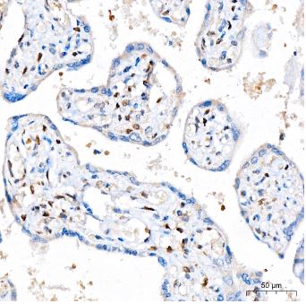 FGF basic/FGF2/bFGF Antibody (8W6M5)