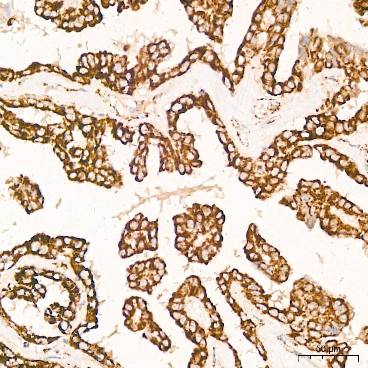 HABP1/C1QBP/GC1q R Antibody (6N7U3)