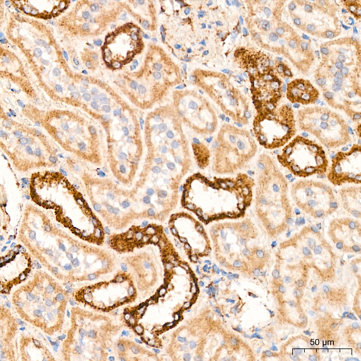 HABP1/C1QBP/GC1q R Antibody (6N7U3)