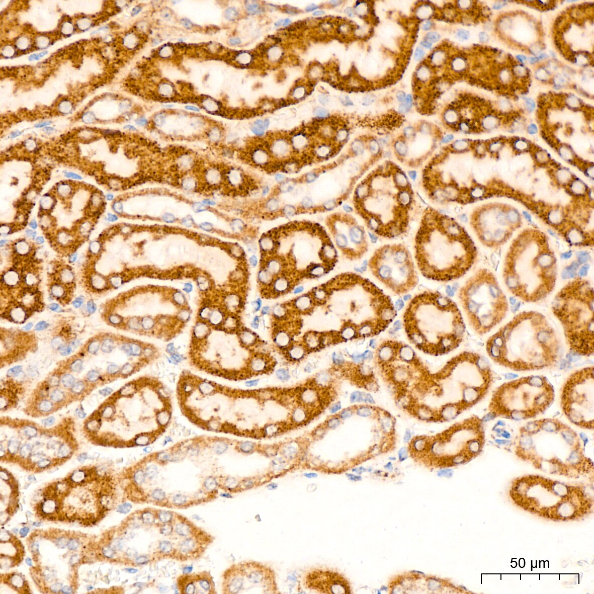 HABP1/C1QBP/GC1q R Antibody (6N7U3)