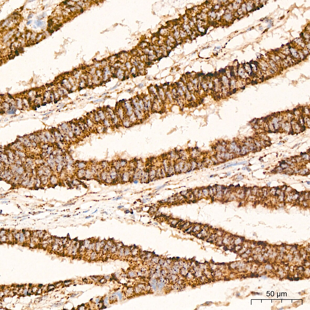 HABP1/C1QBP/GC1q R Antibody (6N7U3)