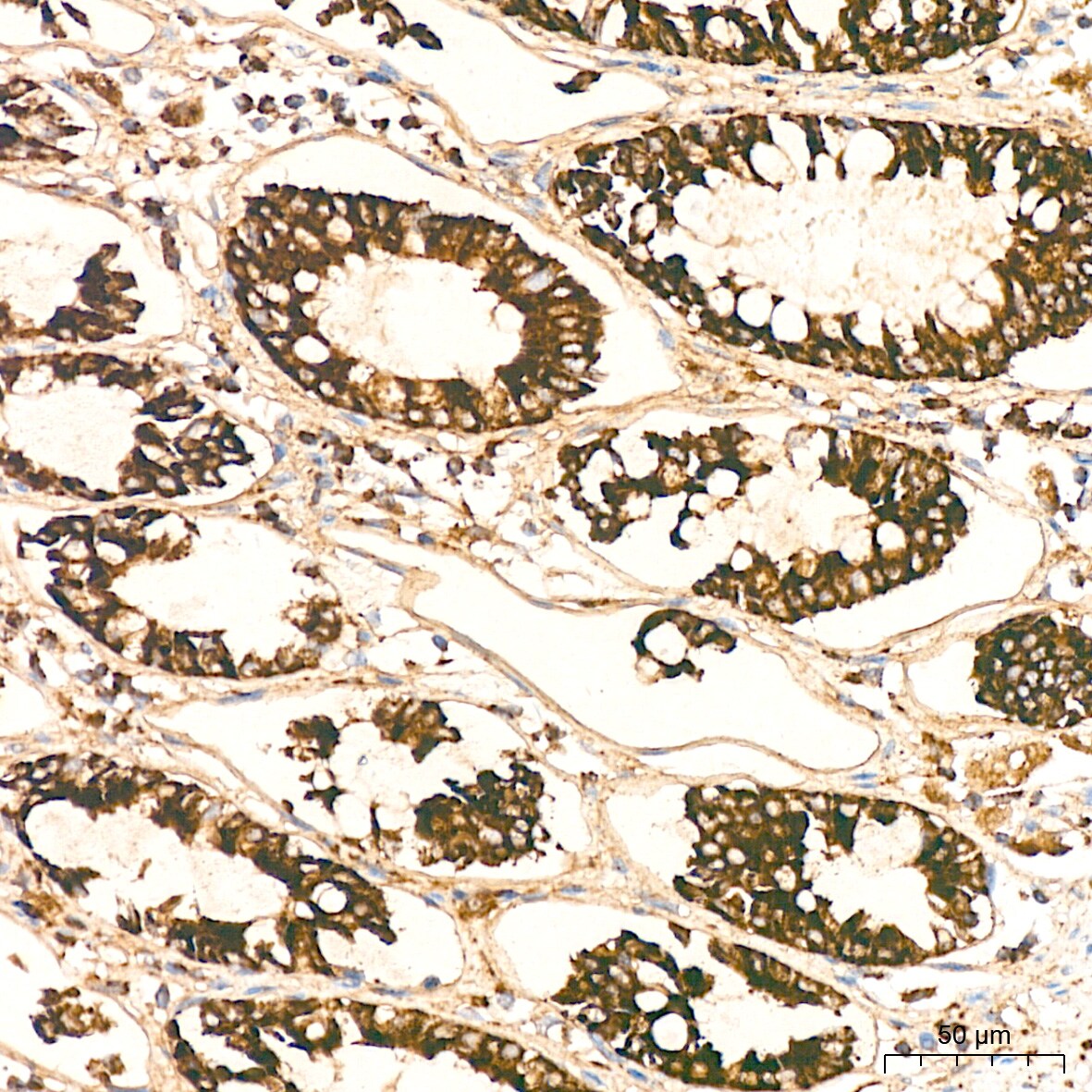 HABP1/C1QBP/GC1q R Antibody (6N7U3)