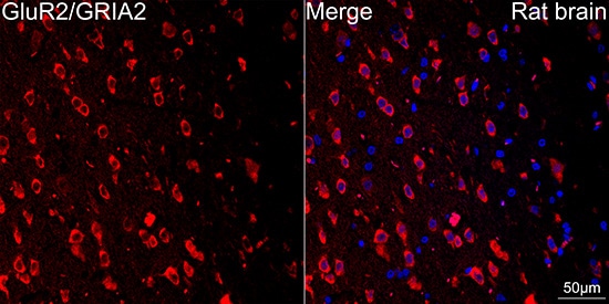 GluR2 Antibody (9R1X2)