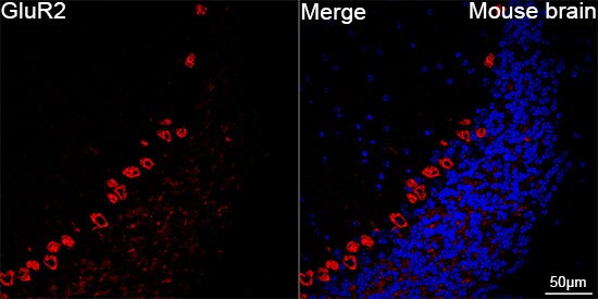 GluR2 Antibody (9R1X2)