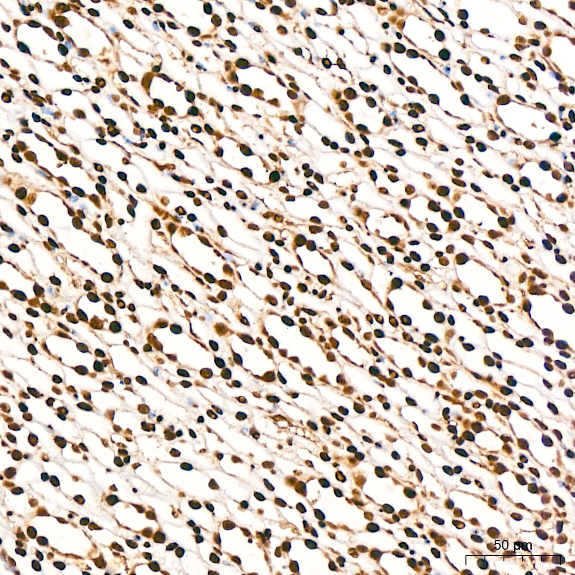 DDX5 Antibody (1K6X10)