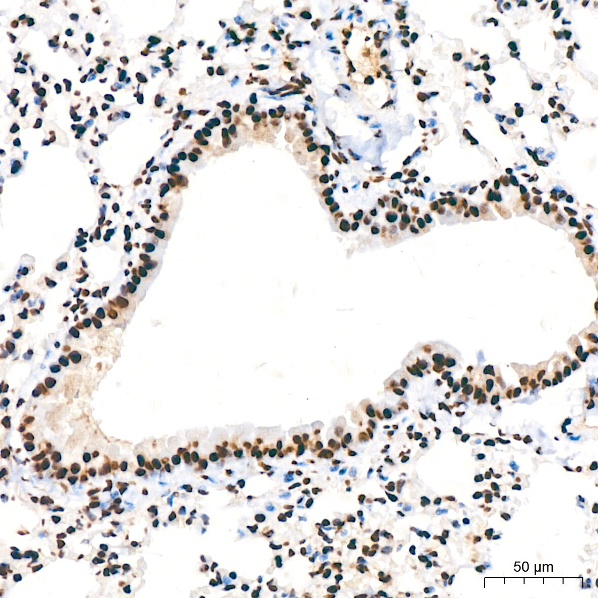 DDX5 Antibody (1K6X10)