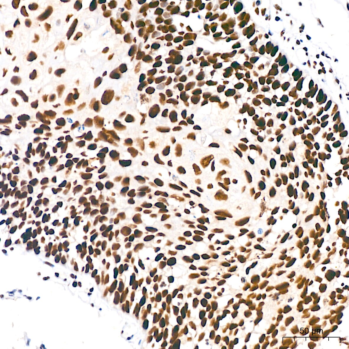 DDX5 Antibody (1K6X10)