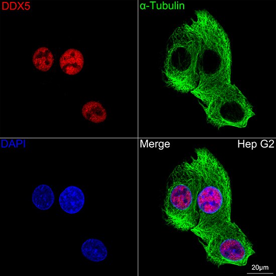 DDX5 Antibody (1K6X10)