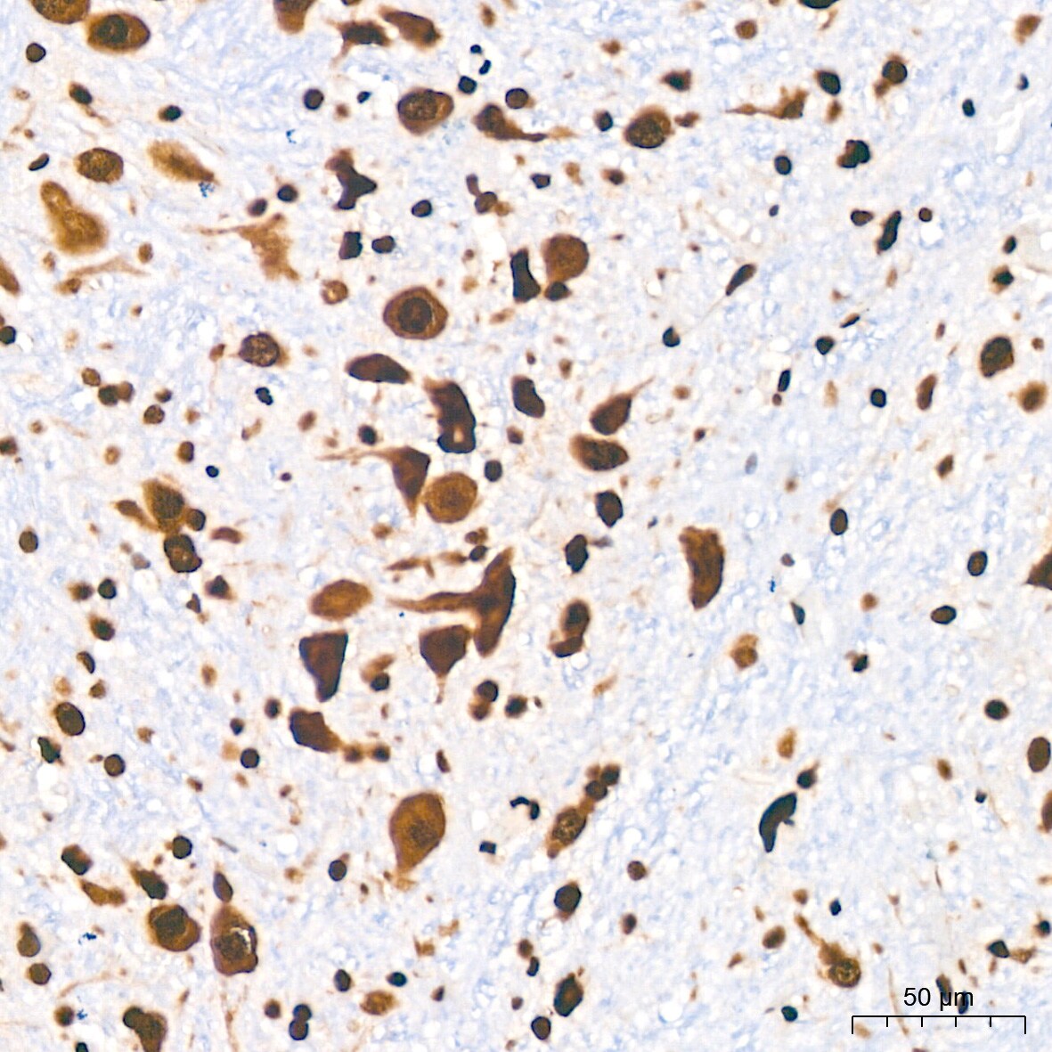 DDX5 Antibody (1K6X10)