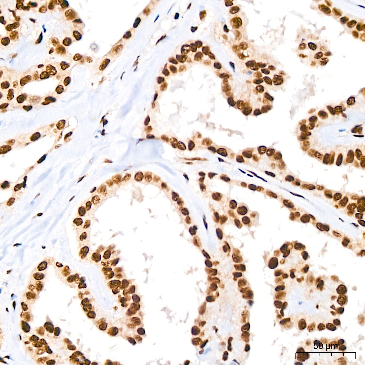 DDX5 Antibody (1K6X10)
