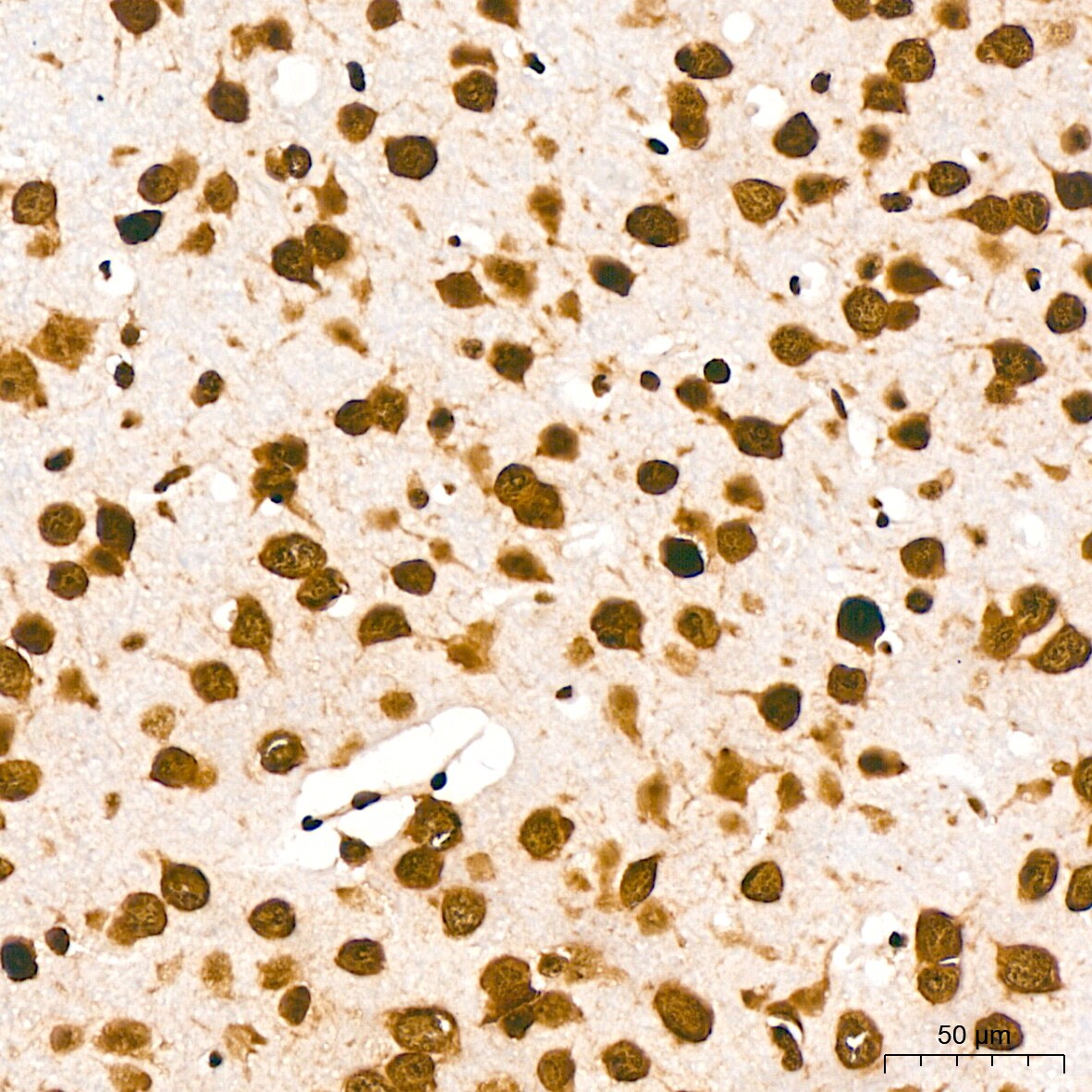 DDX5 Antibody (1K6X10)