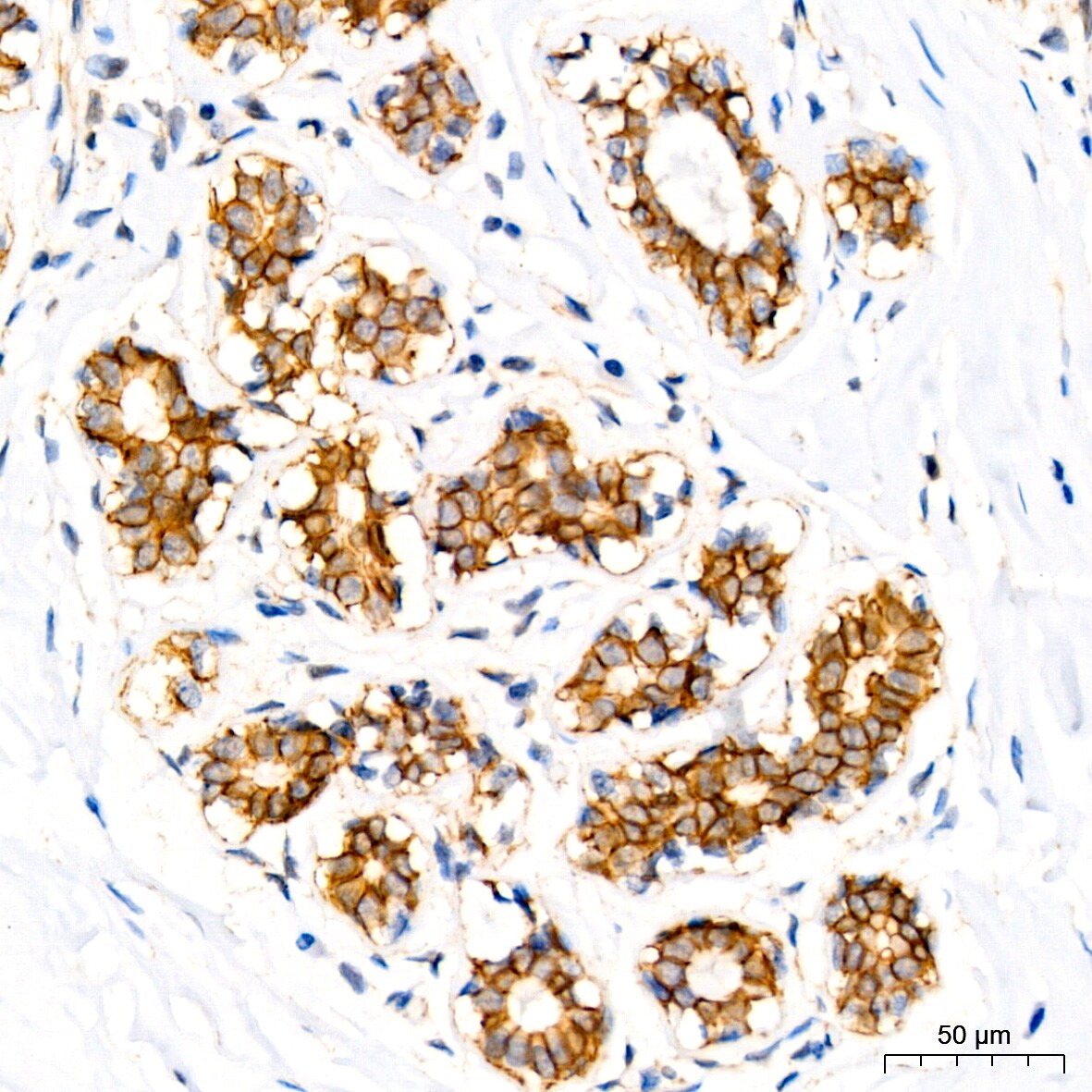p120-catenin Antibody (5N7Z0)