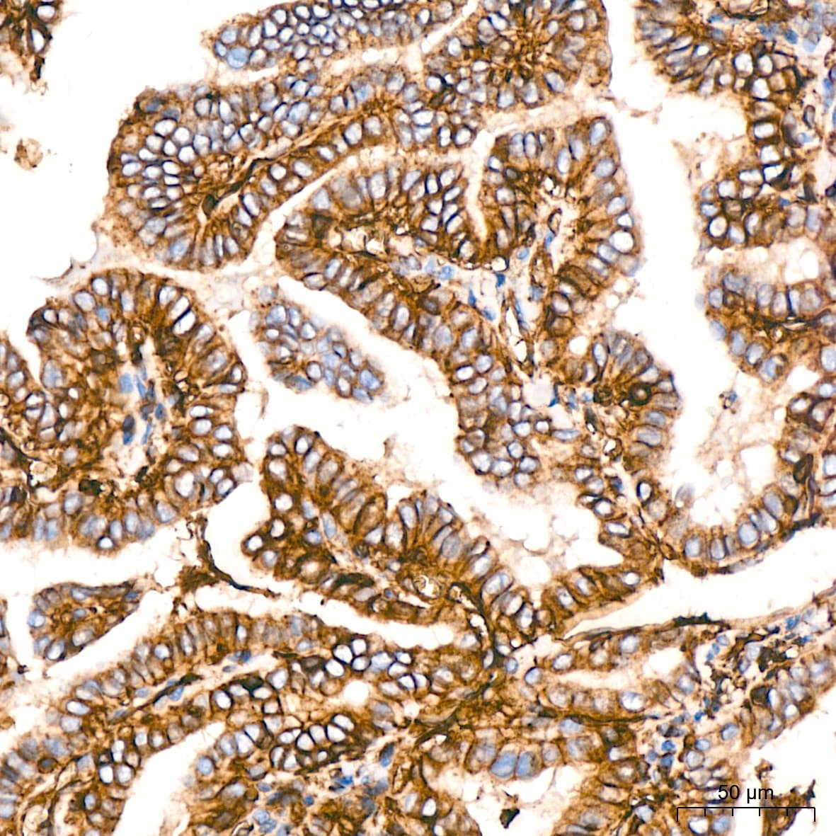 HLA A Antibody (8L2H2)