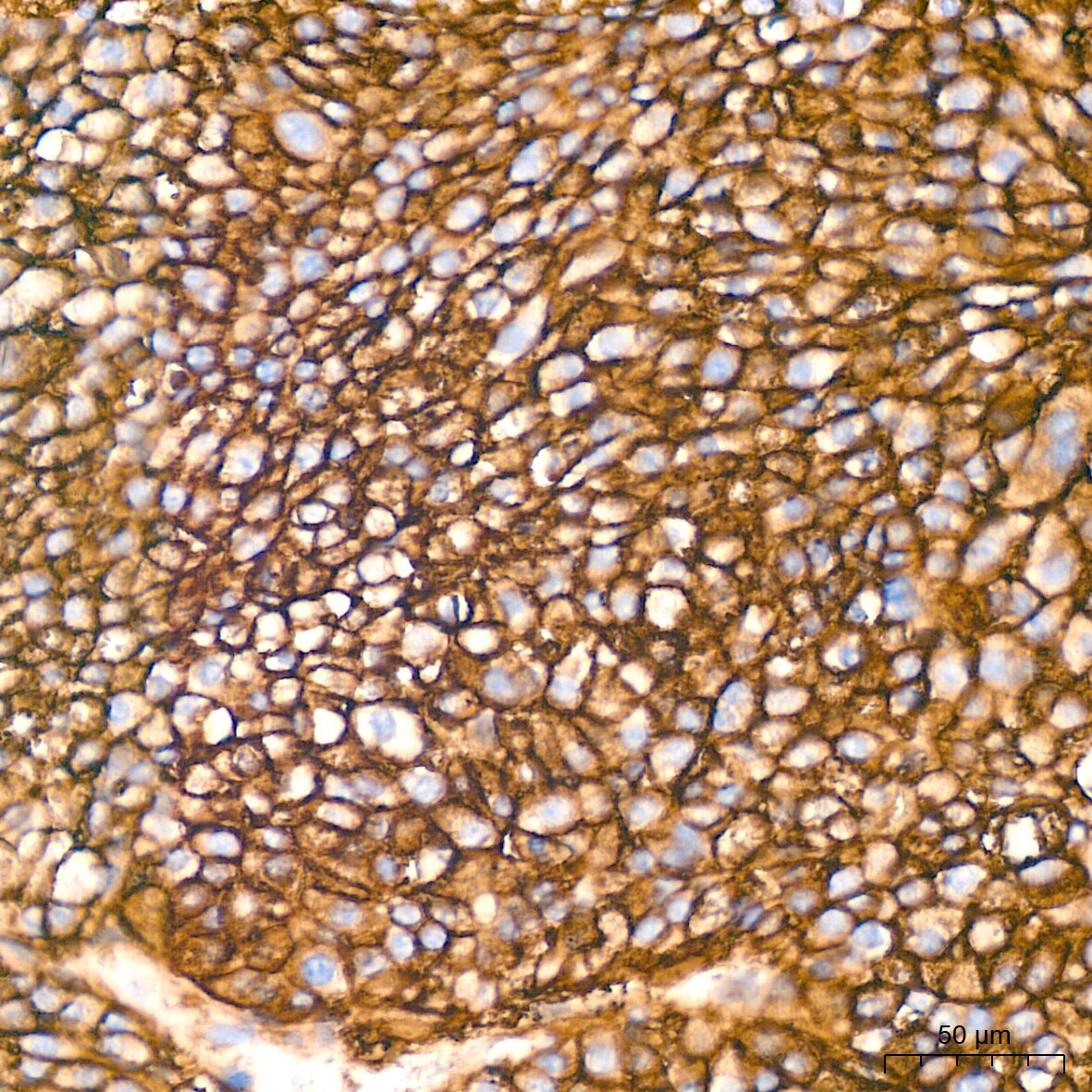 HLA A Antibody (8L2H2)
