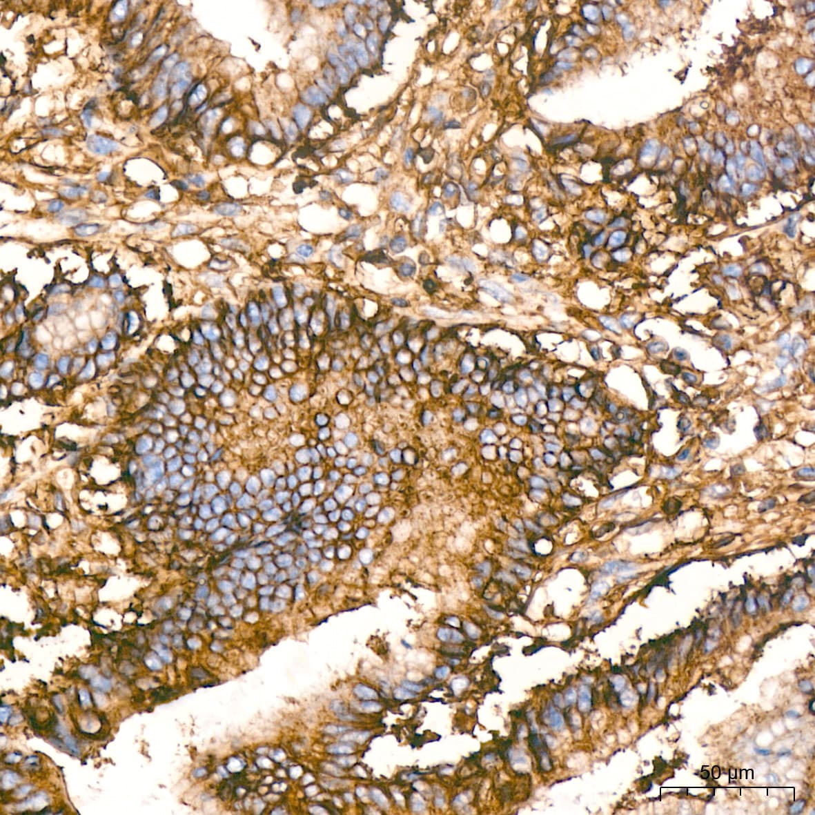 HLA A Antibody (8L2H2)