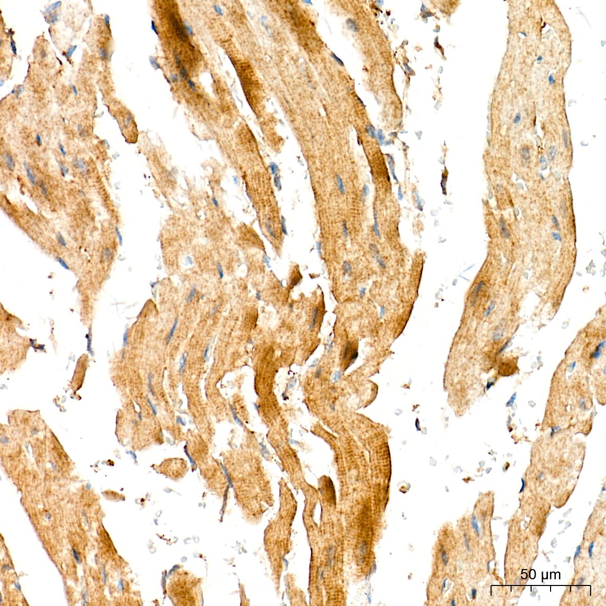 Aldolase A Antibody (4B2E5)