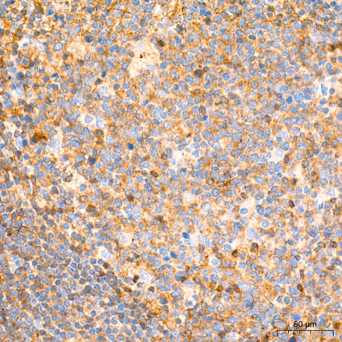 Aldolase A Antibody (4B2E5)