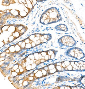 Aldolase A Antibody (4B2E5)