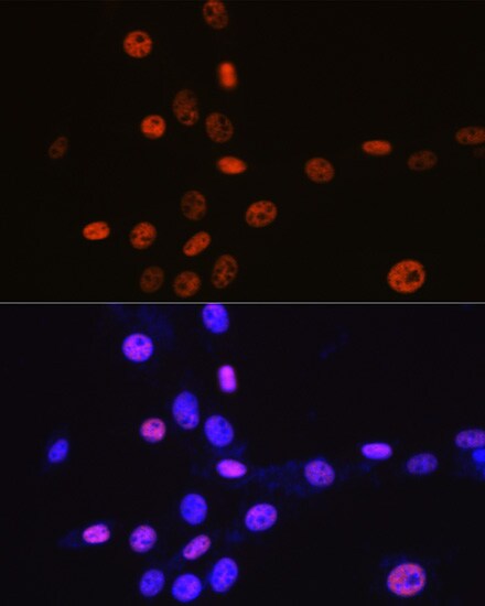 MCM3 Antibody (9Z5W4)
