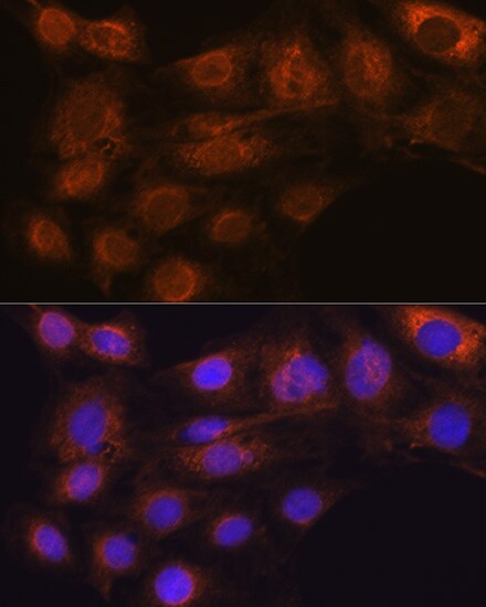 ARF6 Antibody (9E7T9)