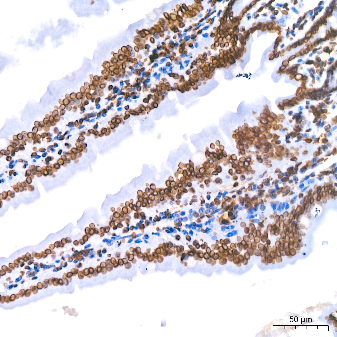 Lamin B1 Antibody (5H8V8)