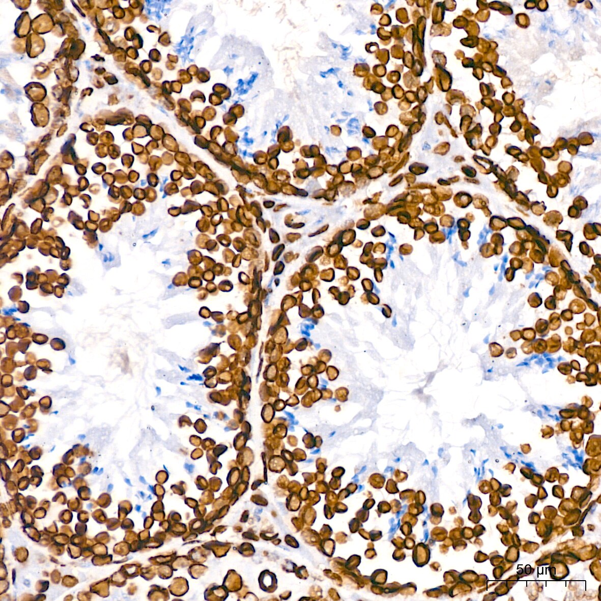 Lamin B1 Antibody (5H8V8)