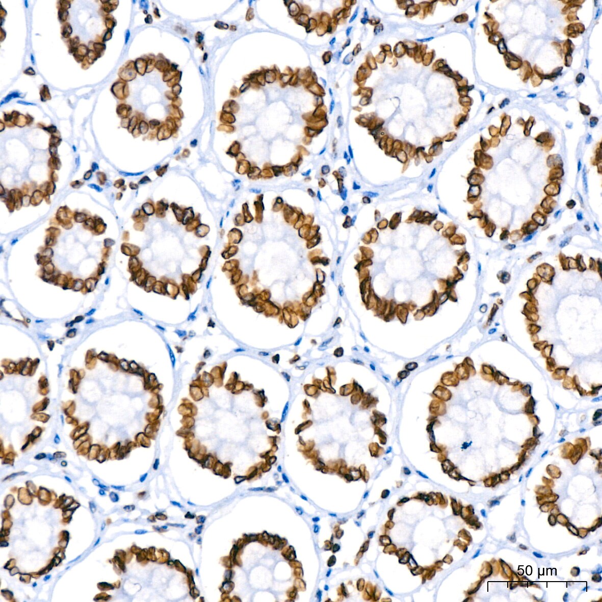 Lamin B1 Antibody (5H8V8)