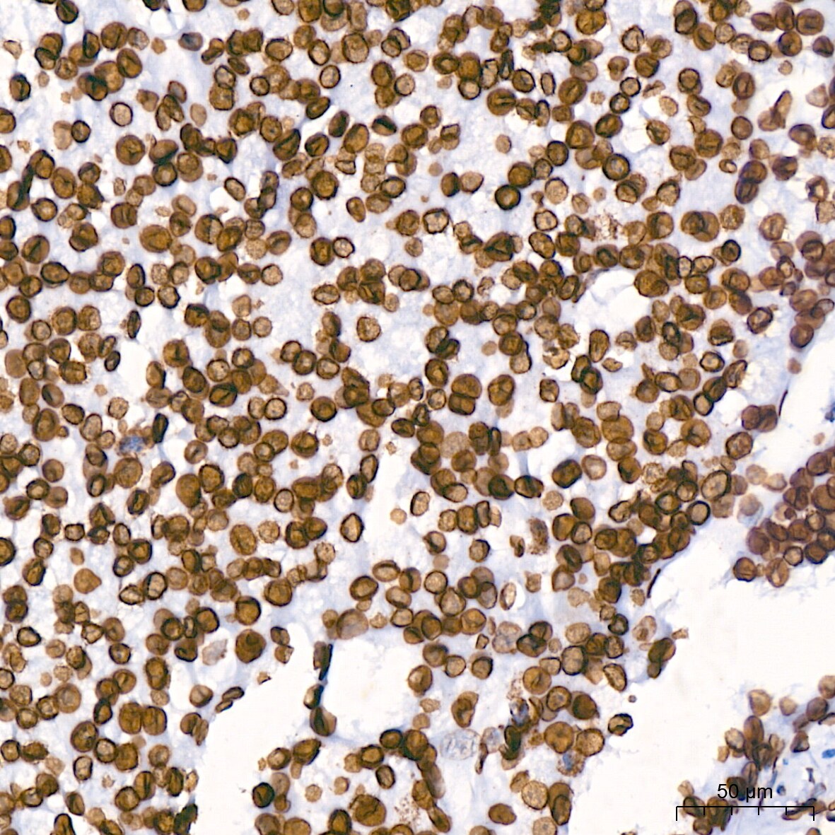 Lamin B1 Antibody (5H8V8)