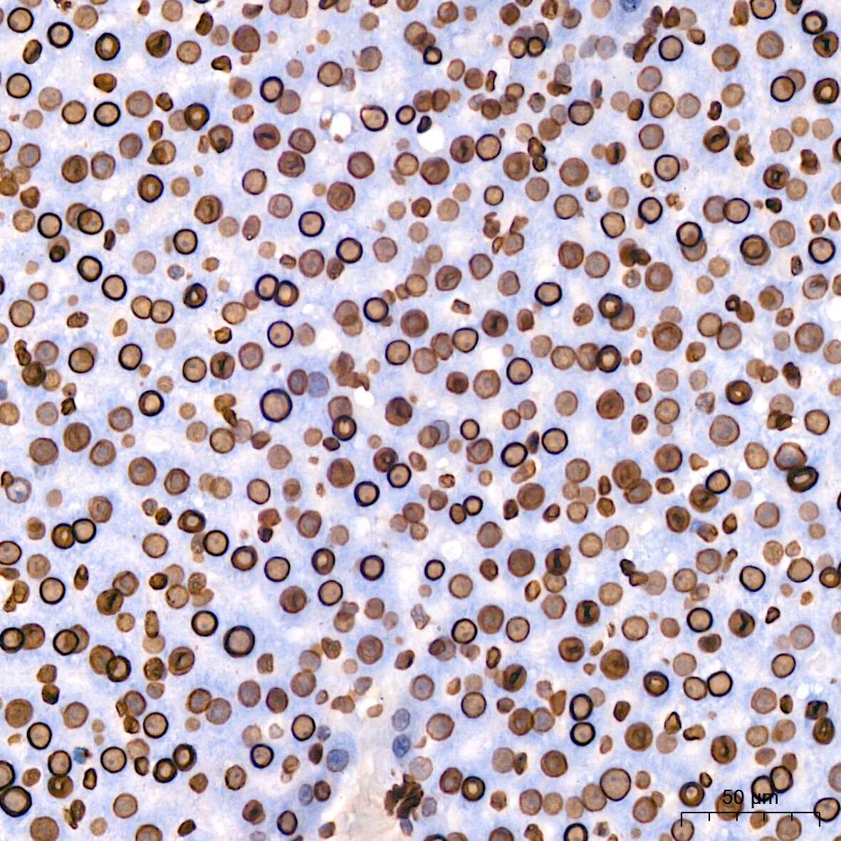 Lamin B1 Antibody (5H8V8)