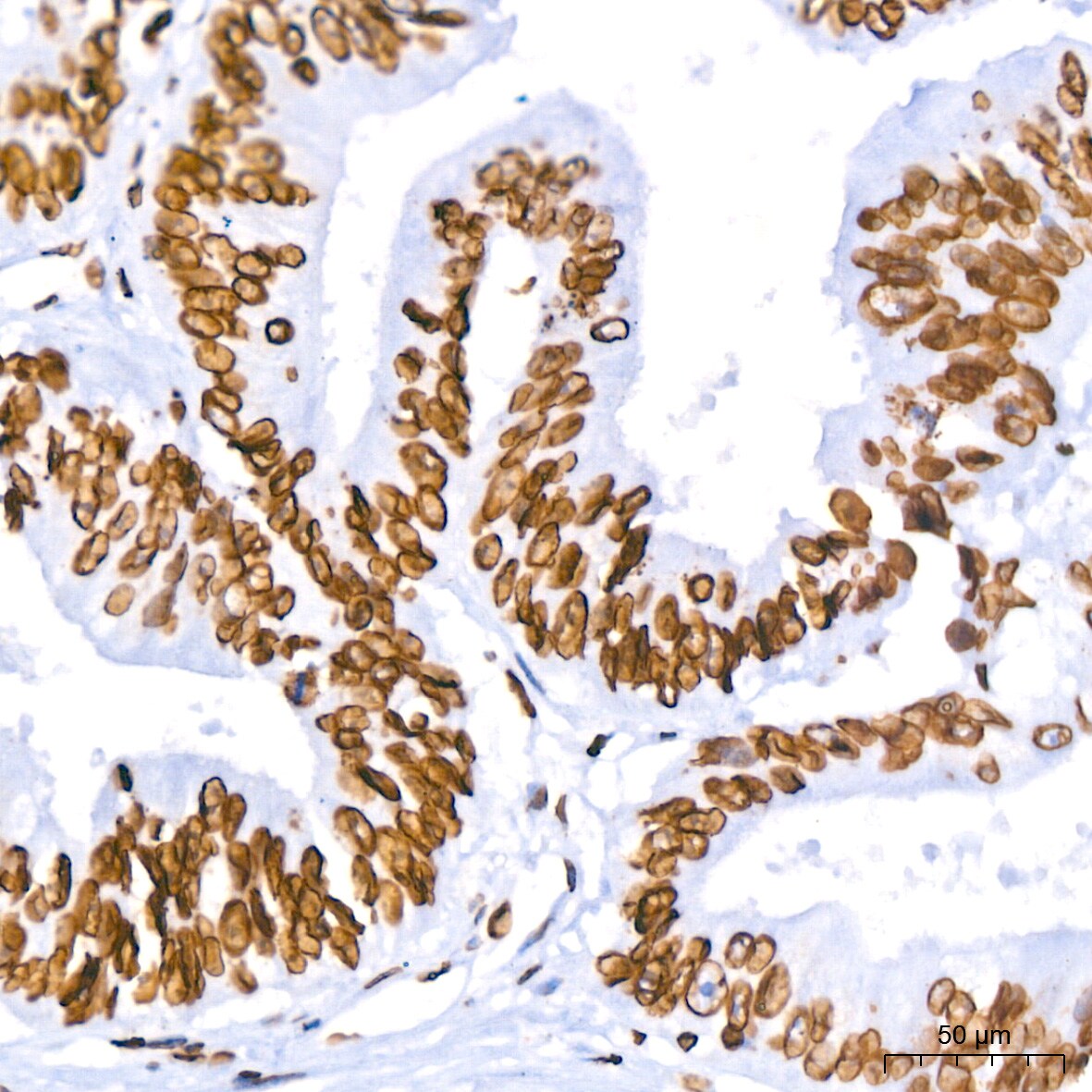 Lamin B1 Antibody (5H8V8)