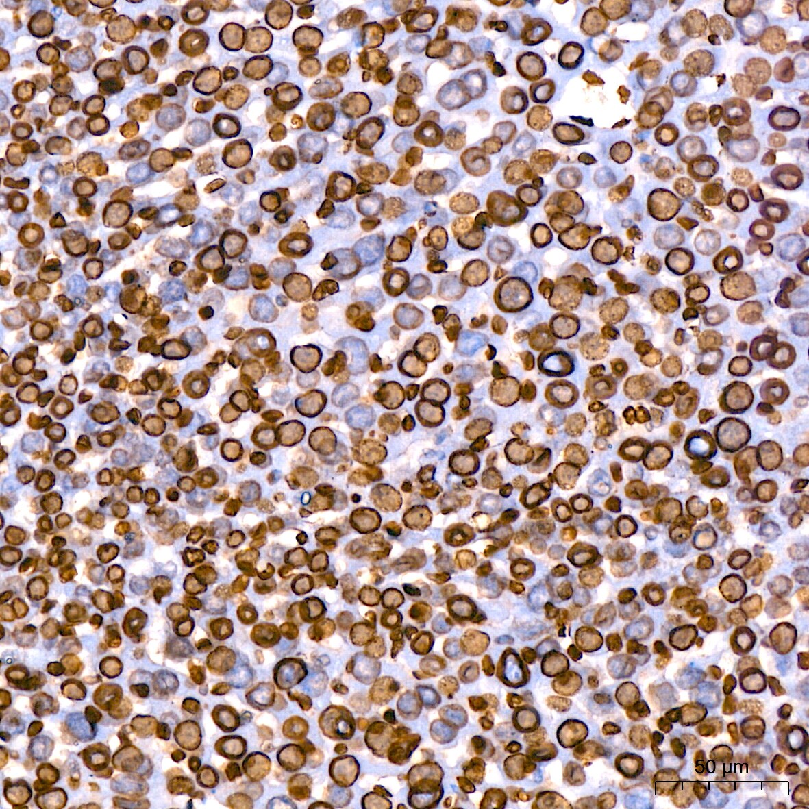 Lamin B1 Antibody (5H8V8)