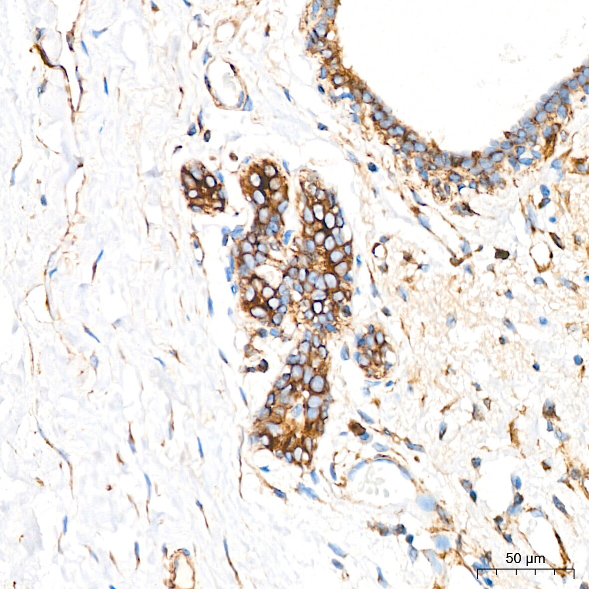 LOX Antibody (9K10Z3)