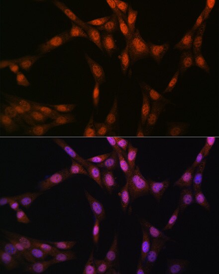 Glutathione Synthetase Antibody (2S9W7)