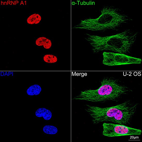 hnRNP A1 Antibody (10N0F4)