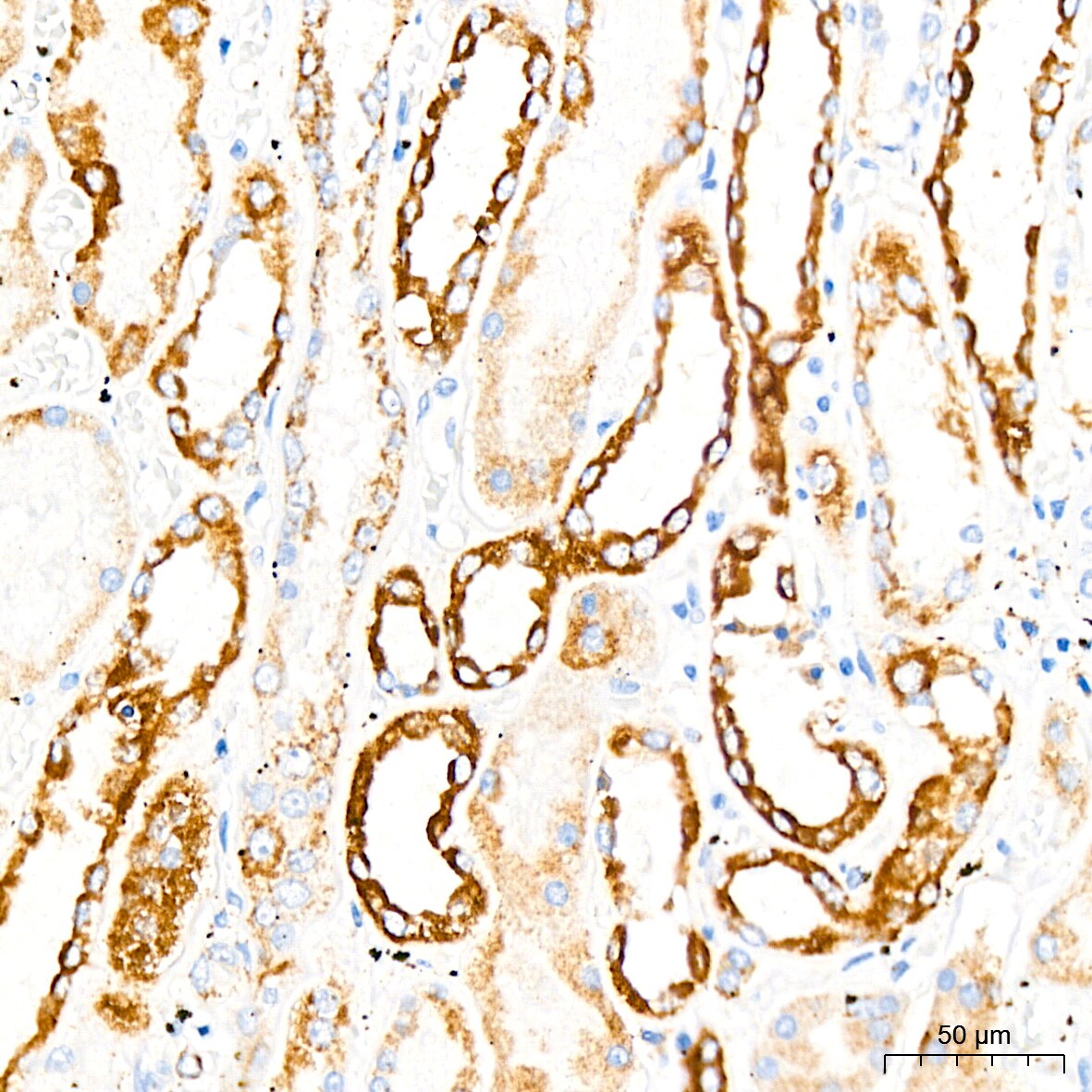Monoamine Oxidase B Antibody (5M8A5)