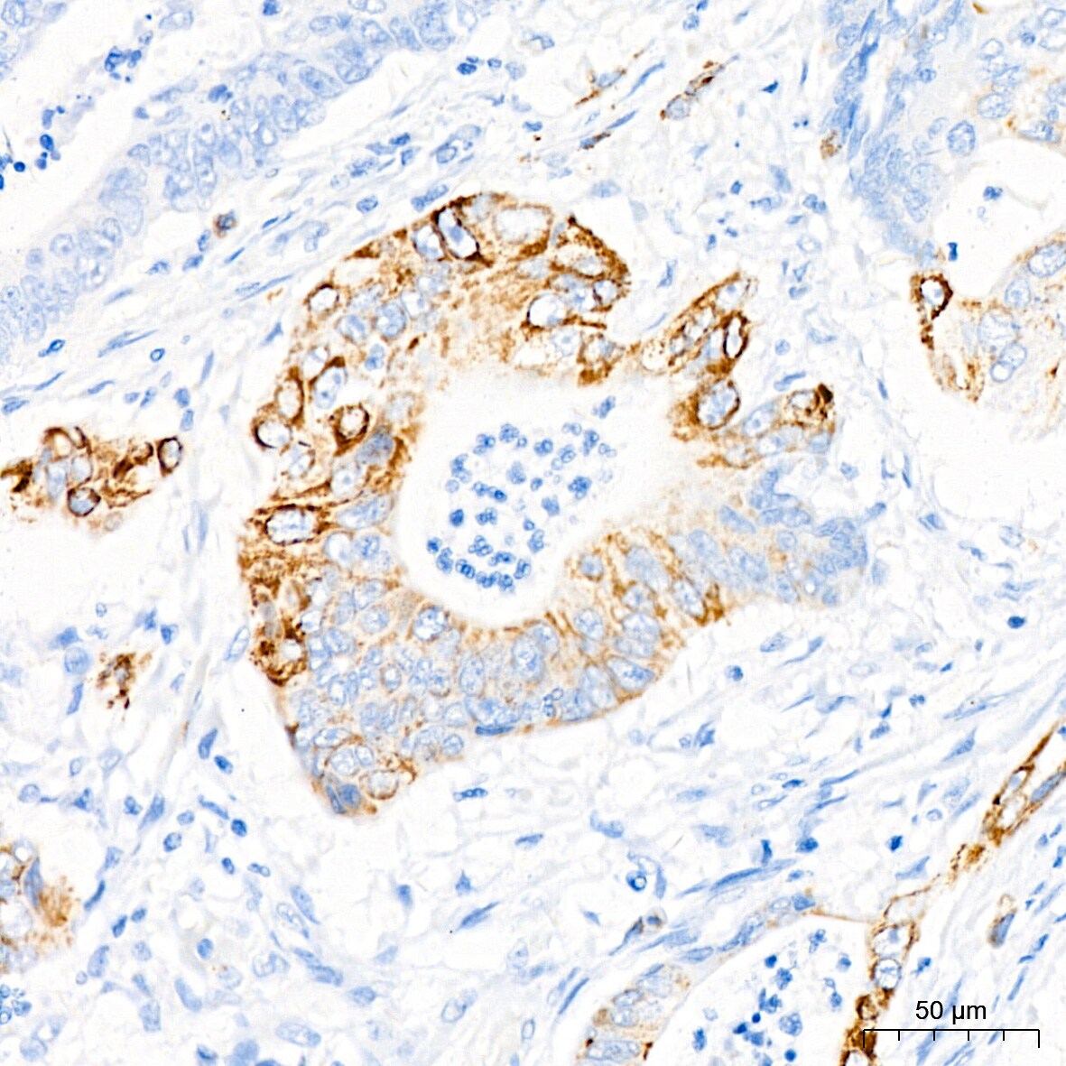 Monoamine Oxidase B Antibody (5M8A5)