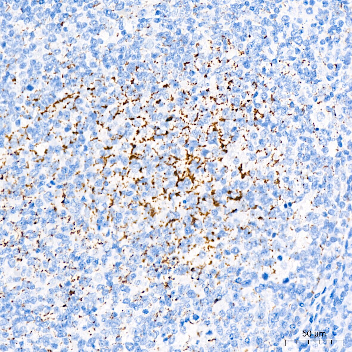 Monoamine Oxidase B Antibody (5M8A5)