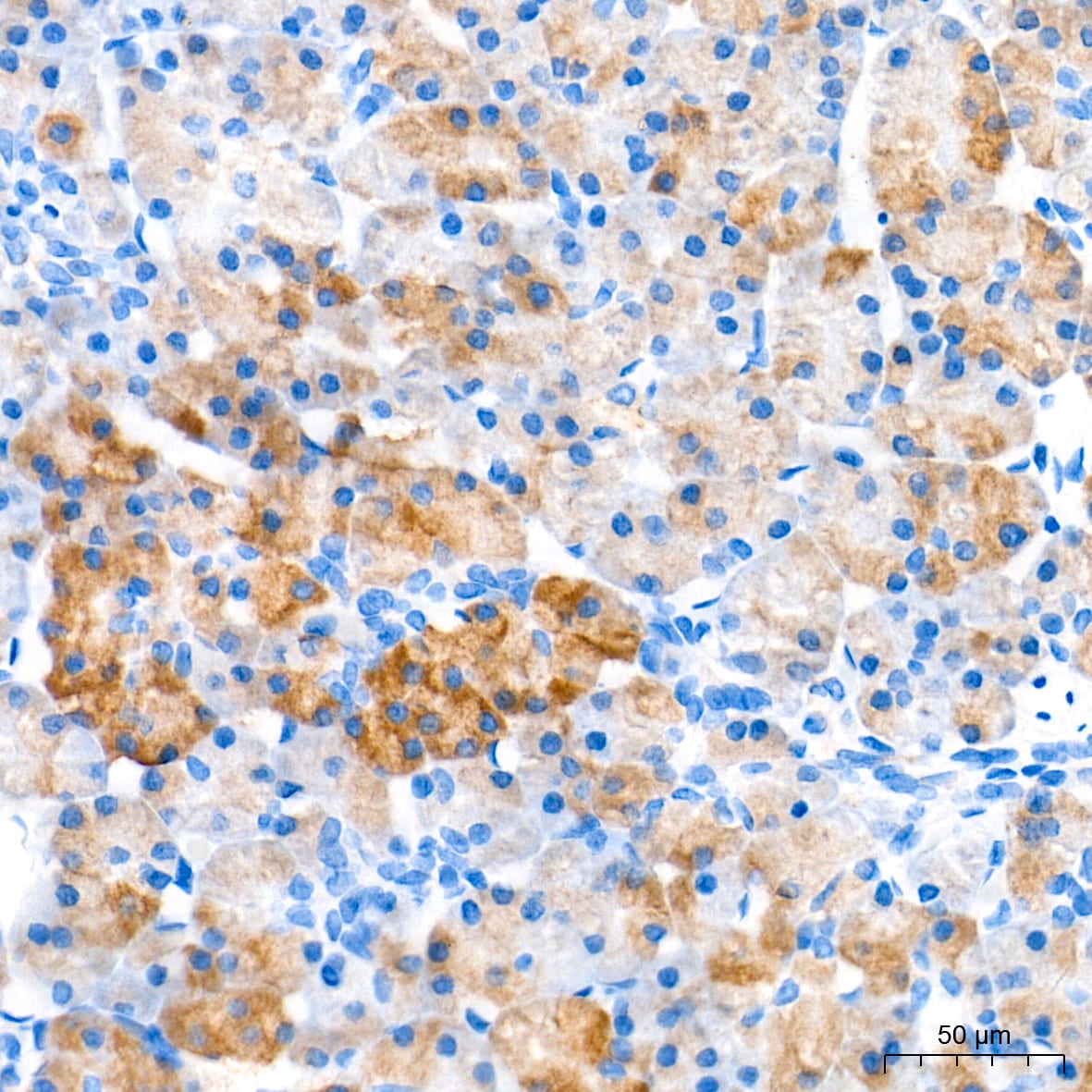 CBS Antibody (1R2E9)