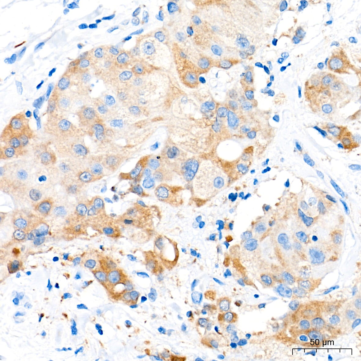 CBS Antibody (1R2E9)