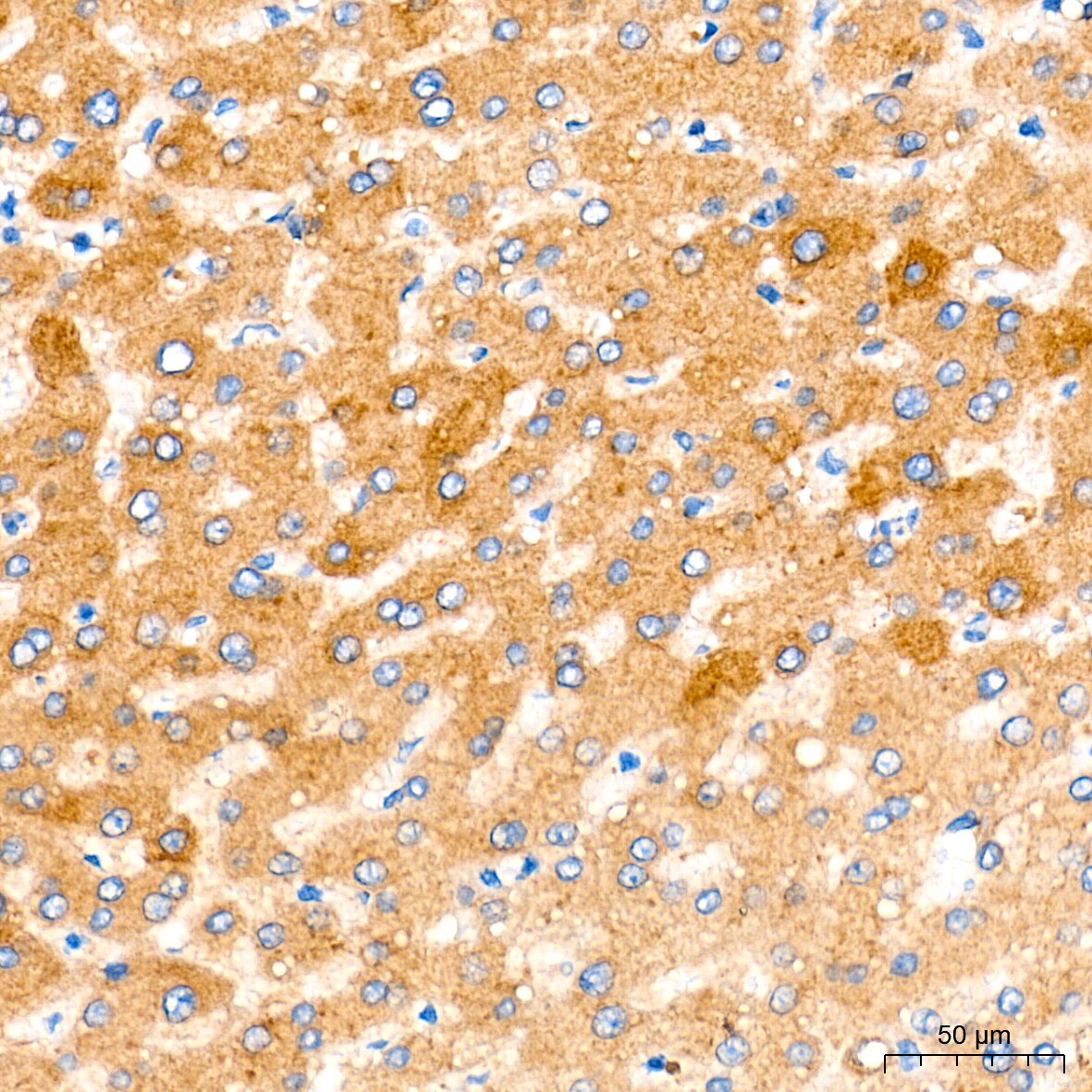 CBS Antibody (1R2E9)