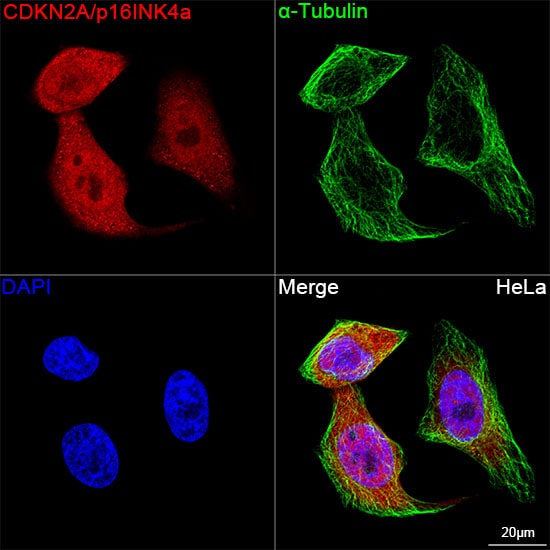 p16INK4a/CDKN2A Antibody (0D0C8)
