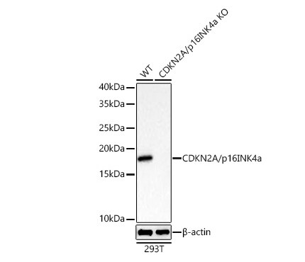 p16INK4a/CDKN2A Antibody (0D0C8)