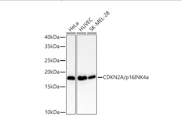 p16INK4a/CDKN2A Antibody (0D0C8)